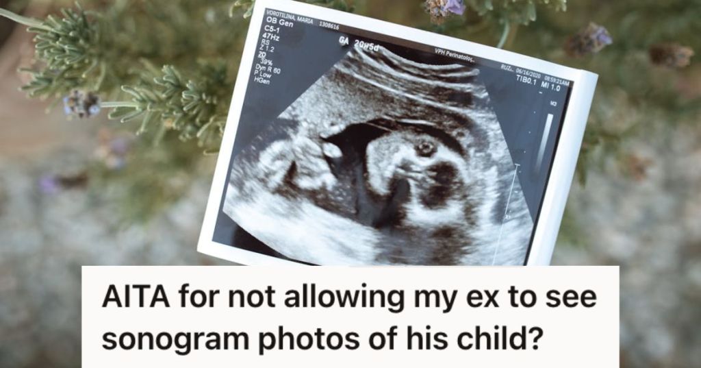 Sonogram of a baby