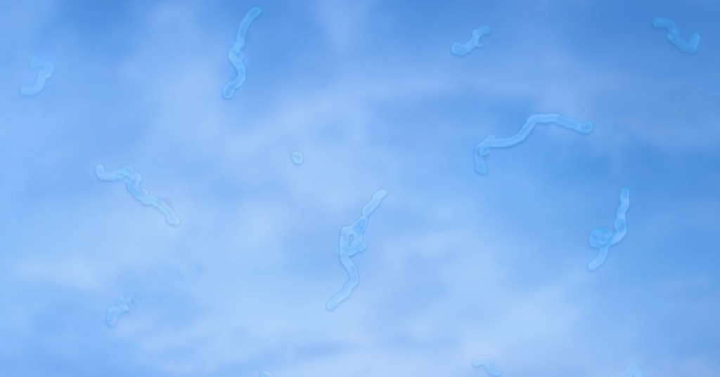 Eye floaters