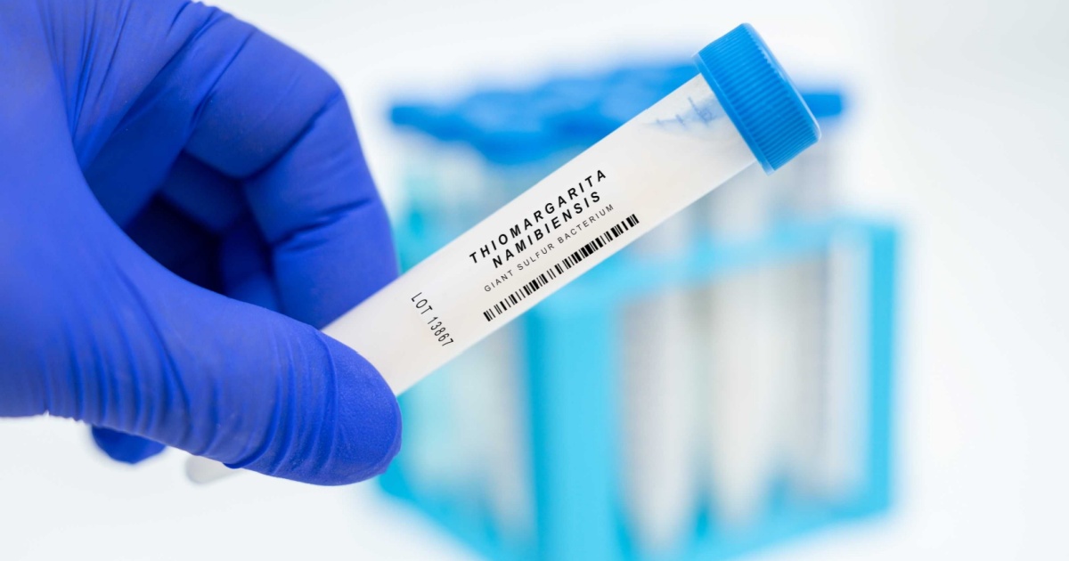 Thiomargarita Magnifica