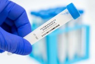 The Largest Bacteria Ever Found Is So Massive That You Can See It With The Naked Eye