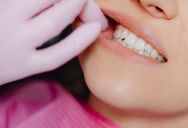 Teen Still Feels Woozy After Wisdom Tooth Surgery And An ER Visit, But Her Parents Insist She Go To Church Anyway